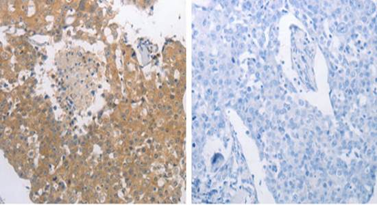 PGA3/PGA4/PGA5 antibody