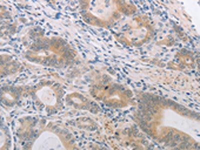 PGA3/PGA4/PGA5 Antibody