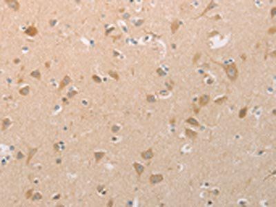 PGA3/PGA4/PGA5 Antibody