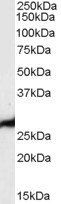 PGAM1/PGAM2/PGAM4 Antibody