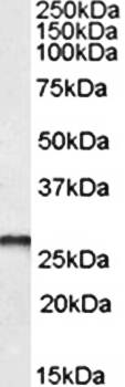 PGAM1/PGAM2/PGAM4 Antibody