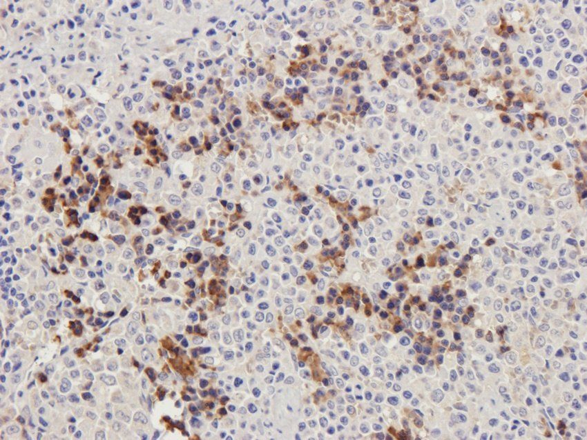 PGBD5 Rabbit Polyclonal Antibody