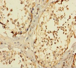 PGM1 Antibody