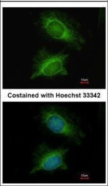 PGM3 Rabbit Polyclonal Antibody