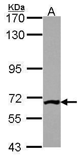 PGM3 Rabbit Polyclonal Antibody