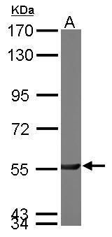 PGM3 Rabbit Polyclonal Antibody
