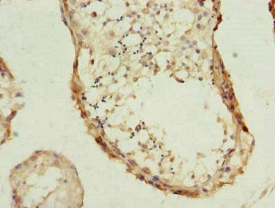 PHF10 Antibody