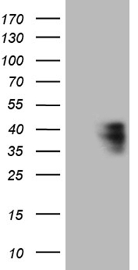 PHGDH Antibody