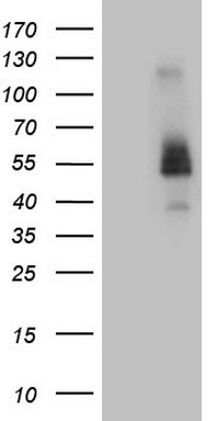 PHGDH Antibody