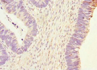 PHKG2 Antibody