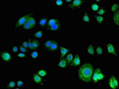 PHLDA3 Antibody