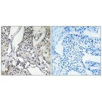 PHLDA3 Antibody