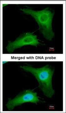 PHLP Rabbit Polyclonal Antibody