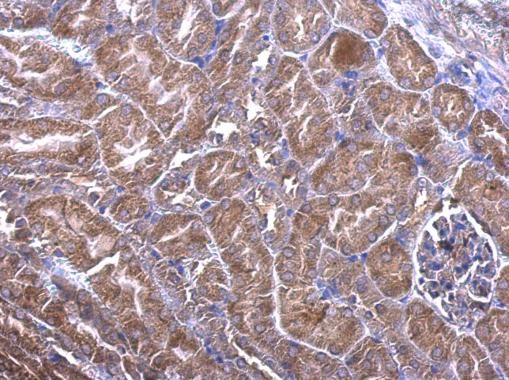 PHLP Rabbit Polyclonal Antibody