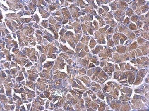 PHLP Rabbit Polyclonal Antibody