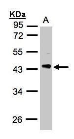 PHLP Rabbit Polyclonal Antibody