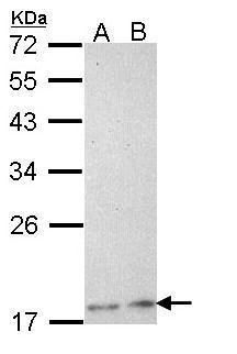 PCNP Rabbit Polyclonal Antibody