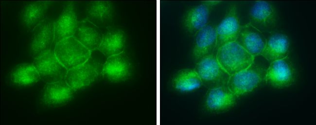 Phospholipid scramblase 1 Rabbit Polyclonal Antibody