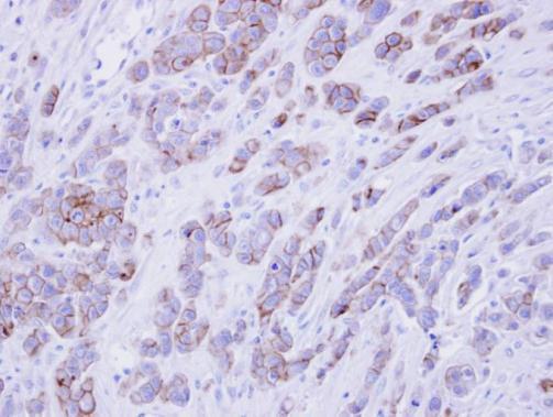 Phospholipid scramblase 1 Rabbit Polyclonal Antibody