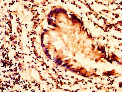 PLTP Antibody