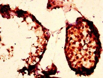 PLTP Antibody