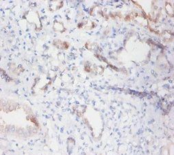 PLTP Antibody