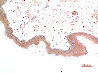 Phospho-SMAD3(S425) Antibody