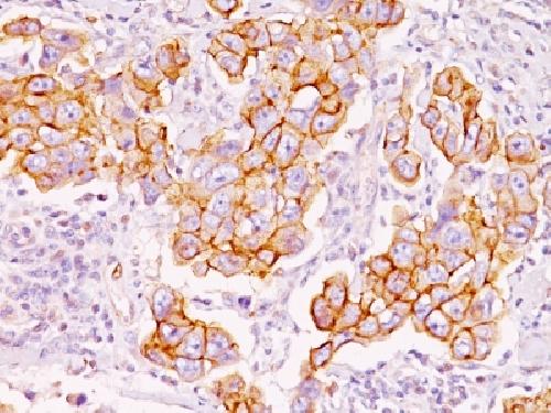 Phosphotyrosine (P-Tyr) Antibody
