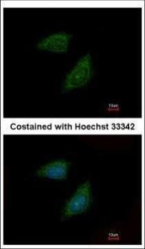 Protease Inhibitor 15 Rabbit Polyclonal Antibody
