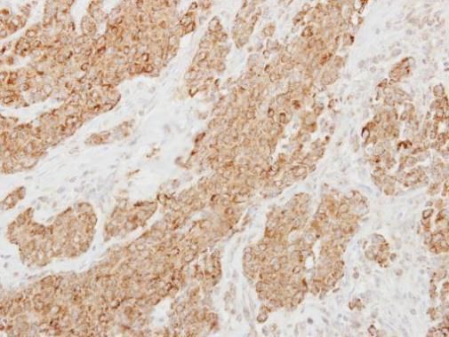 Protease Inhibitor 15 Rabbit Polyclonal Antibody