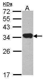 Protease Inhibitor 15 Rabbit Polyclonal Antibody