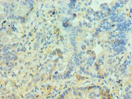 PIAS3 Antibody