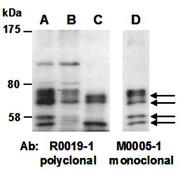 PIASx (C) Antibody, Mouse Monoclonal