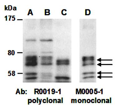 PIASx (C) Antibody, Rabbit Polyclonal