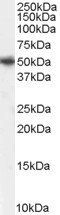 PICK1 Antibody