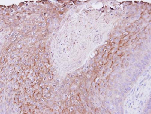 polymeric immunoglobulin receptor Antibody