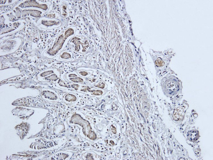 PIGR Rabbit Polyclonal Antibody
