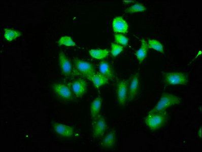 PIH1D1 Antibody