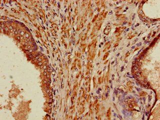 PIH1D3 Antibody
