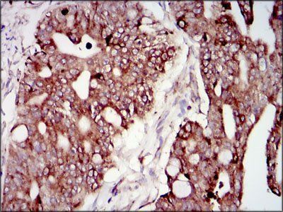 PIK3R1 Antibody
