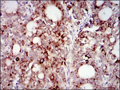 PIK3R1 Antibody