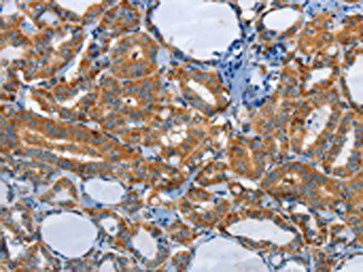 PIK3R4 Antibody
