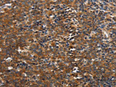 PIK3R4 Antibody