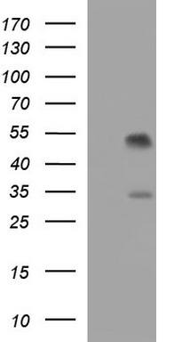 PIK3R5 Antibody