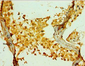 PIKFYVE Antibody