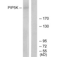 PIKFYVE Antibody