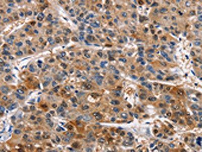 PIM1 Antibody