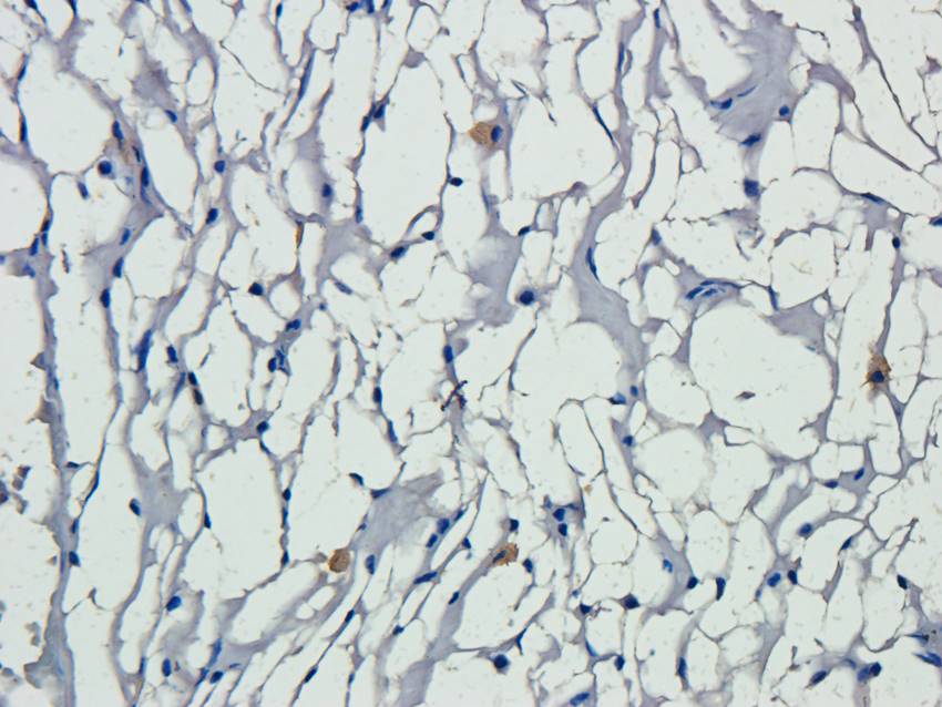 PIM1 Rabbit Polyclonal Antibody