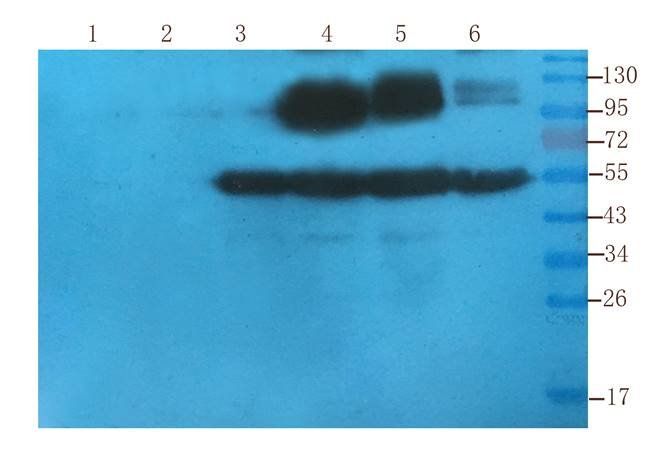 PIM1 Rabbit Polyclonal Antibody