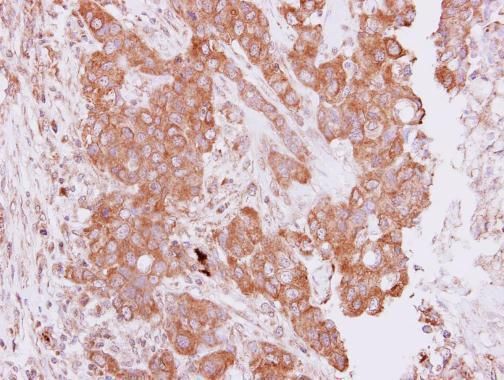 PIM2 Rabbit Polyclonal Antibody
